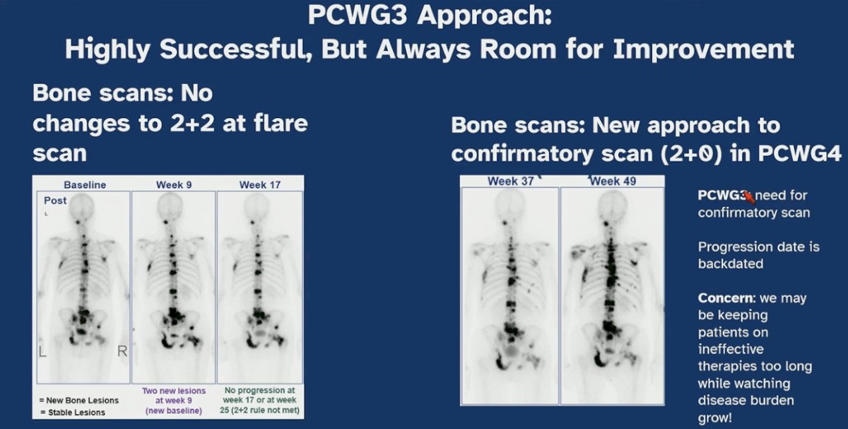 Dr. Armstrong reviewed key imaging principles carried forward from PCWG2 and PCWG3 into PCWG4. Imaging endpoints should remain simple, globally feasible, and avoid reliance on proprietary software models that may become obsolete. Importantly, imaging-based endpoints are considered candidates until clinically validated, and radiographic progression as a regulatory endpoint does not necessarily mean loss of treatment benefit. He revisited the 2+2 rule for bone scans, which requires confirmation of new lesions to distinguish true progression from flare. PCWG4 proposes refinement of the confirmatory scan approach, including the 2+0 rule (Shown below), while acknowledging the concern that mandatory confirmation may delay recognition of ineffective therapy in some patients.