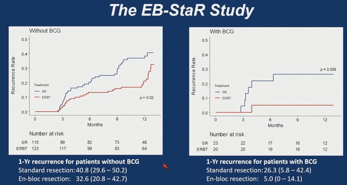Additional analyses examined recurrence stratified by intravesical therapy use. Among patients who did not receive BCG, the 1-year recurrence rate was 40.8% after standard resection compared with 32.6% after ERBT. Among patients receiving BCG, recurrence rates were 26.3% with standard resection and 5% with ERBT, suggesting that high-quality tumor resection may enhance the effectiveness of adjuvant intravesical therapy.