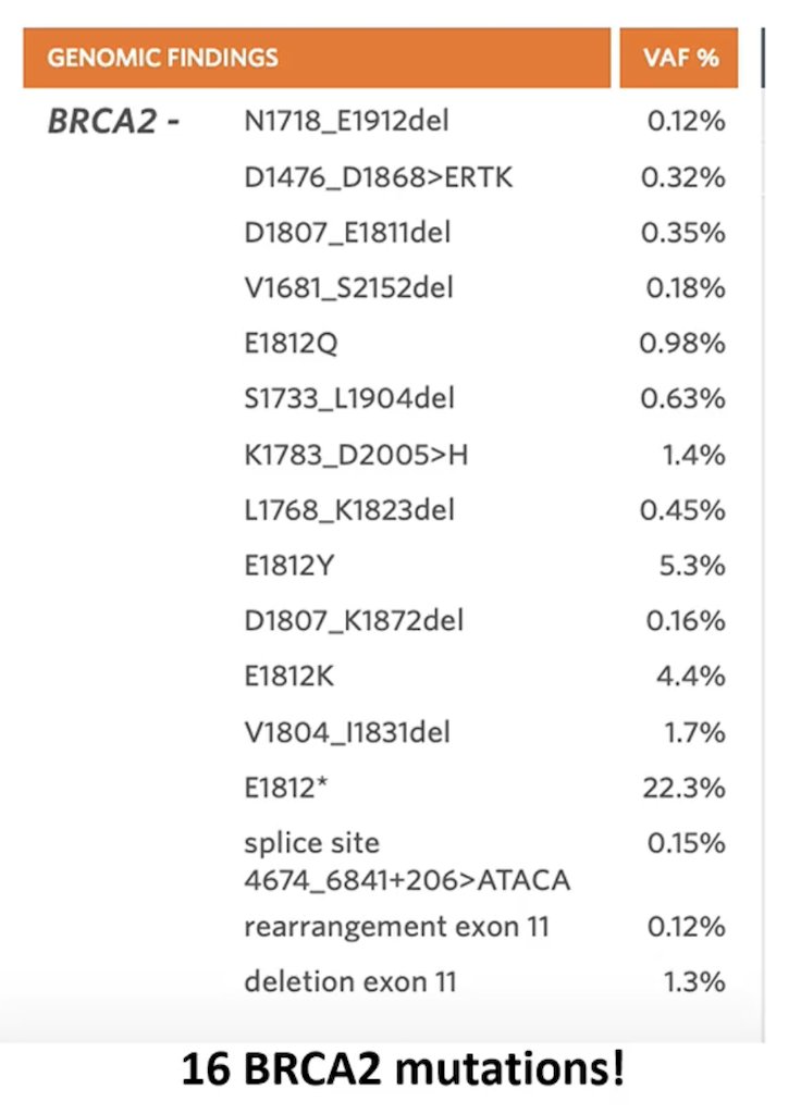 This report identified a single copy deletion of BRCA2 at 13a13.1, and taken together with the loss-of-function mutation, this event is predicted to contribute to biallelic inactivation of BRCA2. This patient was subsequently started on olaparib, with his PSA going from 703 ng/mL to 111 ng/mL, with ctDNA counts improving on therapy, as well as a clinical improvement (ie, energy, pain). However, 6 months later, his PSA increased to 285.40 ng/mL, and he re-presented with new spinal cord compression. Repeat ctDNA showing 16 BRCA2 mutations: