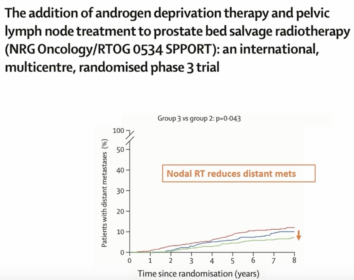 With respect to radiotherapy dose, he argued that there is no good evidence supporting dose escalation in the postoperative salvage setting. He referenced the SAKK 09/10 trial, a randomized phase III study evaluating conventional-dose versus dose-intensified salvage radiotherapy for biochemically recurrent prostate cancer after prostatectomy. In this study, 344 men were randomized to prostate bed radiotherapy to either 64 Gy (n=170) or 70 Gy (n=174). The primary endpoint was freedom from biochemical progression. At long-term follow-up, dose intensification did not improve outcomes, with a hazard ratio of 1.14 (95% CI: 0.82–1.60; log-rank p=0.44).2 Thus, escalating from 64 Gy to 70 Gy did not translate into better biochemical control, while previous reports from this trial have also shown greater toxicity with the higher dose. Based on these data, Dr. Parker concluded that there is no good evidence for routine dose escalation. His practical recommendation was to use 52.5 Gy in 20 fractions to the prostate bed and 55 Gy in 20 fractions to the macroscopic recurrence. 2