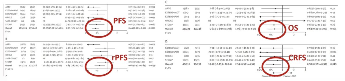 The WOLVERINE meta-analysis was published in early 20261 and amalgamated individual patient data across trials to evaluate the effectiveness of metastasis-directed therapy for oligometastatic prostate cancer. Overall, 7 phase 2 trials (n = 574) were included in the analysis. There were 6 trials randomly assigning 472 patients to metastasis-directed therapy + standard of care (n = 248) versus standard of care (n = 224) used to evaluate metastasis-directed therapy, and had a median follow-up time of 40.7 months (IQR 25.6-53.7). Metastasis directed therapy was associated with improved progression free survival (trial level HR 0.44, 95% CI 0.35-0.56, p < 0.0001; patient level HR 0.45, 95% CI 0.35-0.57, p < 0.0001), radiographic progression free survival (trial level HR 0.60, 95% CI 0.42-0.85, p = 0.0039; patient level HR 0.59, 95% CI 0.46-0.76, p < 0.0001), and castration resistance free survival (trial level HR 0.58, 95% CI 0.37-0.92, p = 0.019; patient level HR 0.58, 95% CI 0.37-0.91, p = 0.017). The association between metastasis-directed therapy and overall survival showed an HR of 0.63 (95% CI 0.39-1.00, p = 0.051) in trial-level analyses and 0.64 (95% CI 0.40-1.01, p = 0.057) in patient-level analyses: