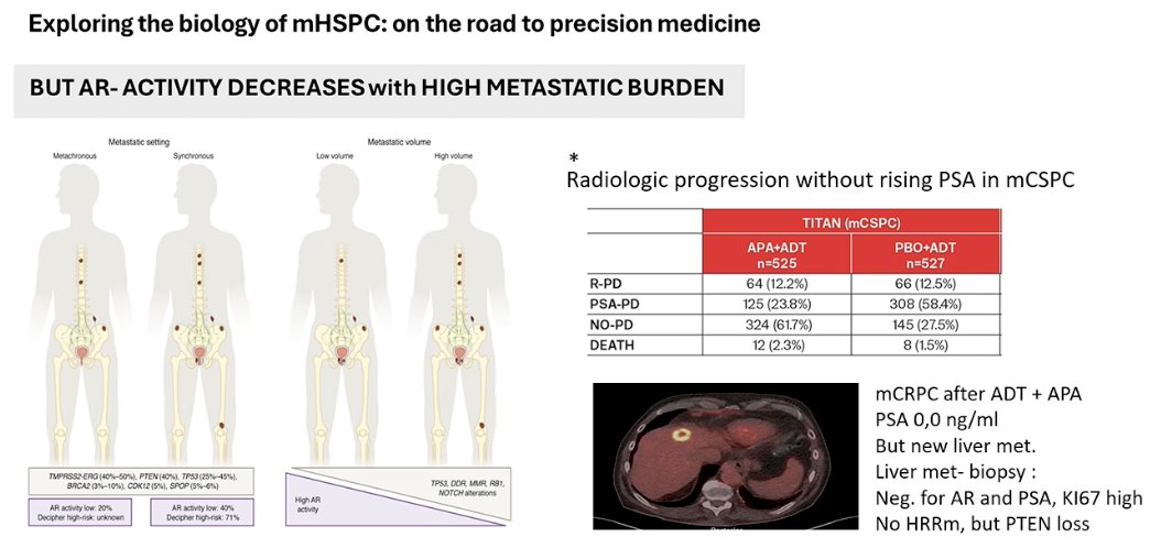 Dr. Kramer then discussed the emerging biological differences between patients with high- and low-volume mHSPC, noting that distinct genomic profiles may underlie these clinical phenotypes. For example, alterations such as PTEN loss appear more frequently in patients with higher metastatic burden, suggesting different tumor biology. He also highlighted data from the TITAN trial5 showing that approximately 10% of patients may experience radiologic progression without a corresponding rise in PSA, reflecting AR-independent disease biology. As an example, he presented a case of a patient treated with ADT + apalutamide who developed a new liver metastasis despite a PSA of 0.0 ng/mL; biopsy confirmed an AR- and PSA-negative tumor with high Ki-67 and PTEN loss, illustrating the potential emergence of aggressive AR-independent clones.