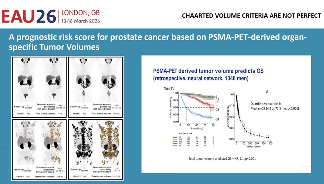 He also noted that current clinical definitions of disease volume, such as the CHAARTED criteria, may be imperfect and may not fully capture the biological heterogeneity of mHSPC. Emerging data suggest that PSMA-PET–derived tumor burden may provide a more precise prognostic assessment. In a retrospective analysis using neural network modeling in more than 1,300 patients, higher total tumor volume on PSMA-PET was strongly associated with worse overall survival. Patients with the highest PSMA-derived tumor burden had markedly shorter survival compared with those with lower tumor volumes, highlighting the potential of advanced imaging-based metrics to refine risk stratification beyond traditional high- versus low-volume classifications.7