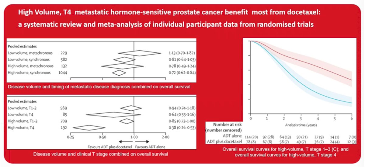 Dr. Kramer also discussed a meta-analysis of individual participant data from randomized trials evaluating the benefit of docetaxel in mHSPC. The analysis showed that patients with high-volume synchronous disease derive the greatest benefit from the addition of docetaxel to ADT, with a clear improvement in overall survival. In contrast, the benefit appeared more limited in patients with low-volume or metachronous disease.