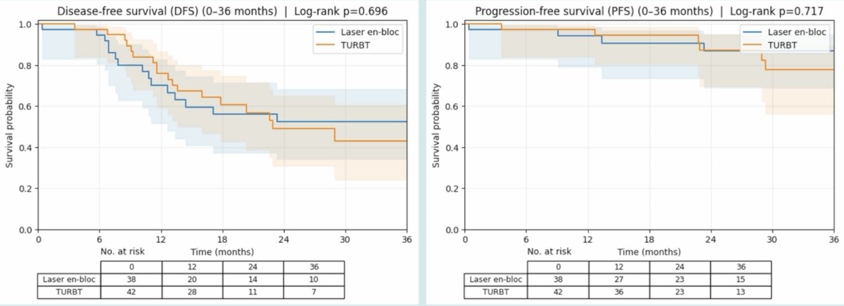 At a mean follow-up of 35 months, disease-free survival and overall survival were comparable between holmium laser en bloc resection and TURBT (disease-free survival log-rank p = 0.696; overall survival log-rank p = 0.717):&nbsp;