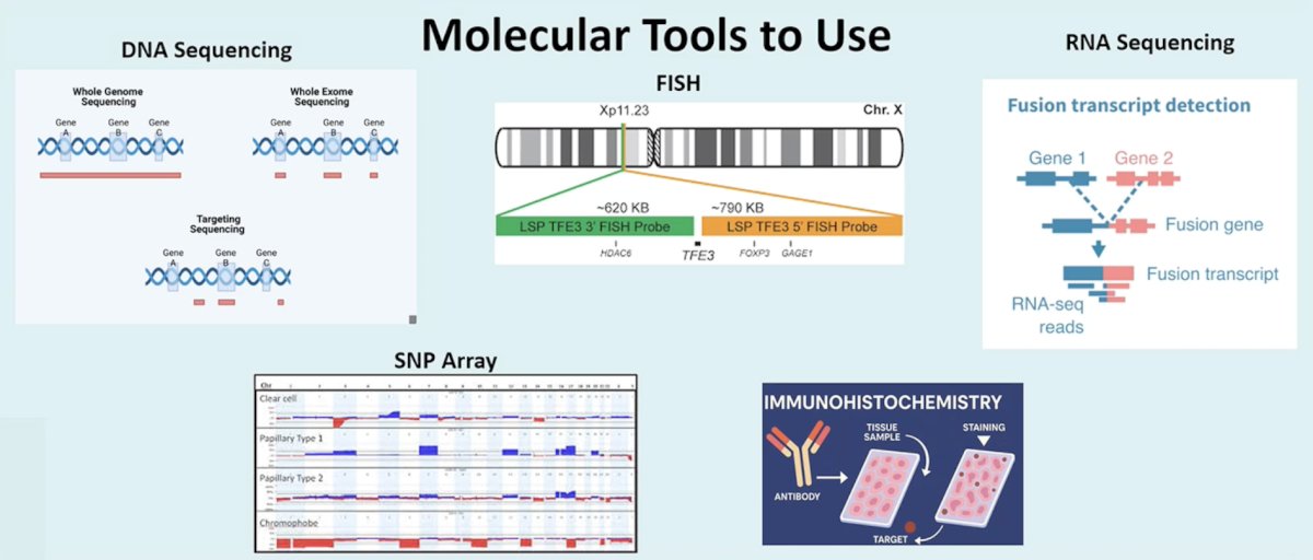 The modern-day urologic oncologist needs to have good tools, but it is also essential that these tools be used in the right way. These molecular tools include (i) DNA sequencing, (ii) SNP array, (iii) FISH, (iv) immunohistochemistry, and (v) RNA sequencing:&nbsp;