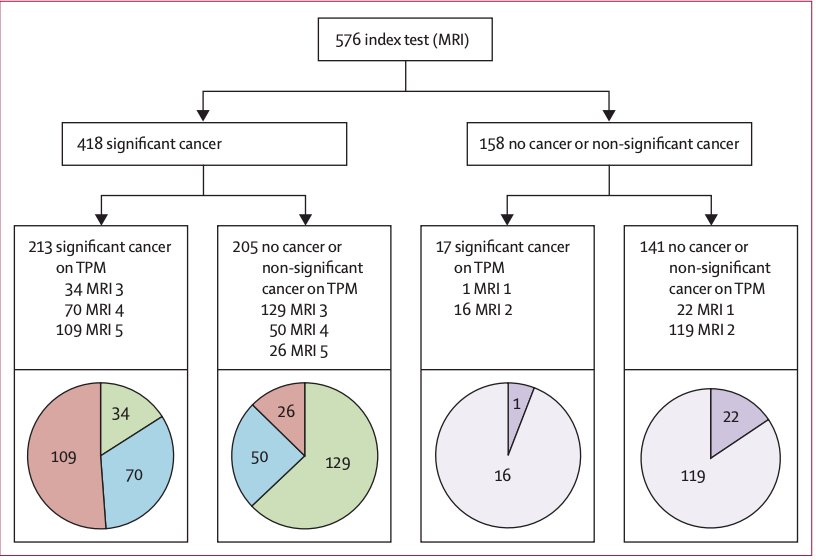In 2020, Sathianathen et al.6 performed a systematic review and meta-analysis of the available literature to update the negative predictive value of mpMRI for clinically significant prostate cancer. Among 42 studies with 7321 patients, the negative predictive value was assessed at 90-93%, which translates to 7-10% of men (depending on the setting) having missed clinically significant prostate cancer with a negative mpMRI if they do not proceed with a prostate biopsy. Next, Dr. Punnen discussed the PROMIS study,7 which demonstrated that MRI outperformed systematic biopsy with an increased sensitivity (93%) and negative predictive value (89%), with the possibility for biopsy avoidance in 27% of cases (negative MRI):