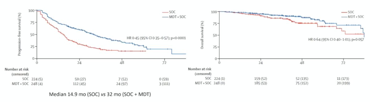 The association between metastasis-directed therapy and overall survival showed an HR of 0.63 (95% CI 0.39-1.00, p = 0.051) in trial-level analyses and 0.64 (95% CI 0.40-1.01, p = 0.057) in patient-level analyses: