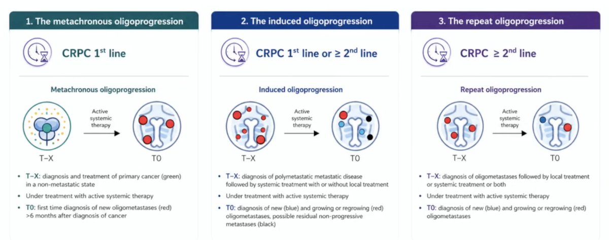 Next, Dr. Zilli noted the different disease settings of oligometastatic CRPC: