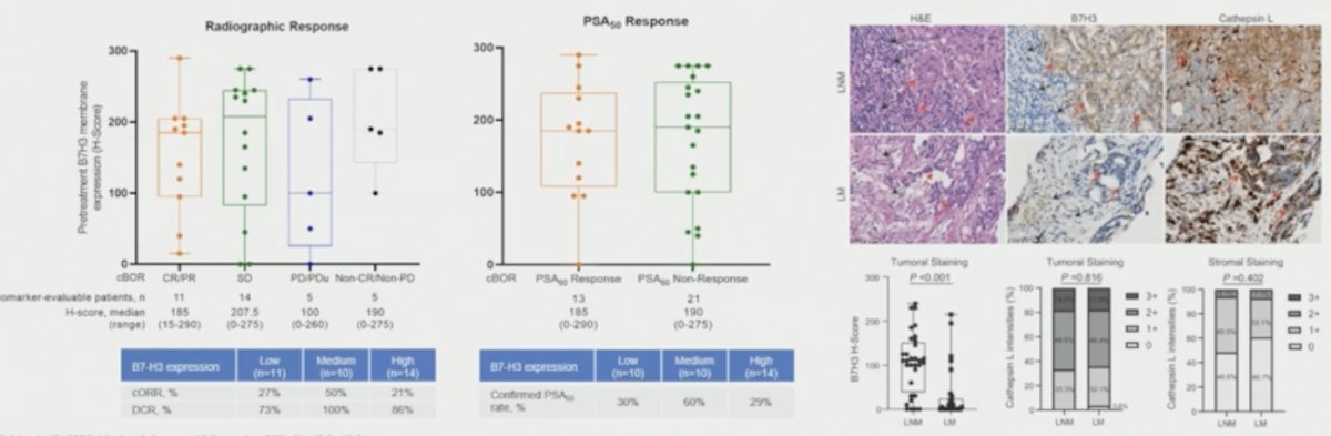 Exploratory biomarker analyses evaluated B7-H3 expression and its association with treatment outcomes. No significant association was observed between baseline B7-H3 expression levels and efficacy outcomes. Interestingly, although B7-H3 expression appeared downregulated in liver metastatic lesions, Cathepsin L, a key enzyme involved in tam-peli cleavage within the tumor microenvironment, maintained robust and comparable expression across both tumor and stromal compartments. Dr. Zhu noted that these findings support a potent bystander effect with tam-peli, potentially representing a mechanistic advantage over ADCs that rely exclusively on intracellular internalization, particularly in aggressive visceral disease such as liver metastases.
