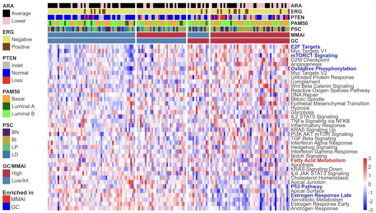 Genomic classifier high versus genomic classifier low/intermediate tumors, however, showed positive enrichment in E2F, oxidative phosphorylation, and mTORC1 pathways; negative enrichment in P53 and estrogen pathways. MMAI high was only negatively enriched for fatty acid metabolism: