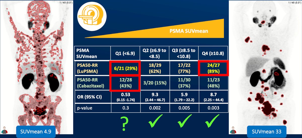 Dr. Emmett then discussed quantitative PET metrics and whether a lower threshold of PSMA expression exists below which response to 177Lu-PSMA therapy is essentially impossible. There is emerging evidence evaluating SUVmean as a potentially more informative biomarker than traditional SUVmax measurements. Can SUVmean identify patients that will not benefit from PSMA-targeted therapy?