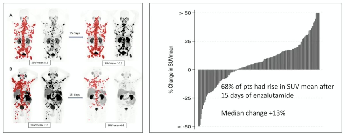 Published earlier in 2026, Emmett et al.5 evaluated the predictive value of early PSMA upregulation for the response to enzalutamide +/- 177Lu-PSMA-617 among patients in ENZA-p. Notably, 68% of patients had a rise in SUVmean after 15 days of enzalutamide:&nbsp;