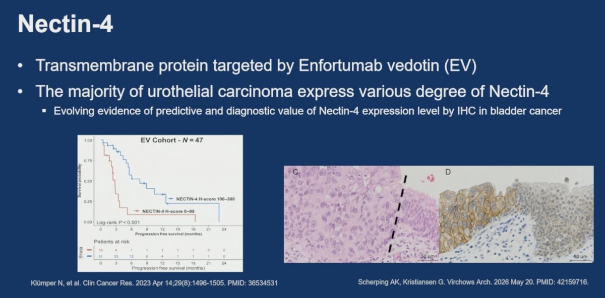 She highlighted data demonstrating improved progression-free survival among patients receiving enfortumab vedotin whose tumors exhibited high Nectin-4 H-scores (100–300) compared to lower expression levels (0–99), supporting a potential predictive role for Nectin-4 assessment. Additional studies have also demonstrated substantial heterogeneity of Nectin-4 expression within tumors.