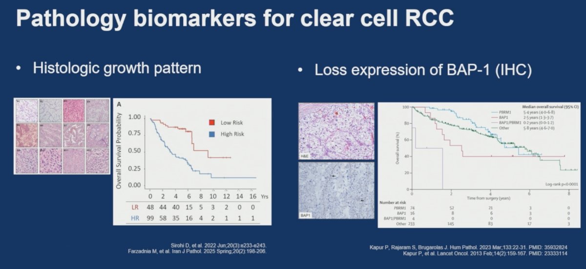These findings reinforce the ongoing importance of traditional pathology assessment alongside molecular biomarker development.