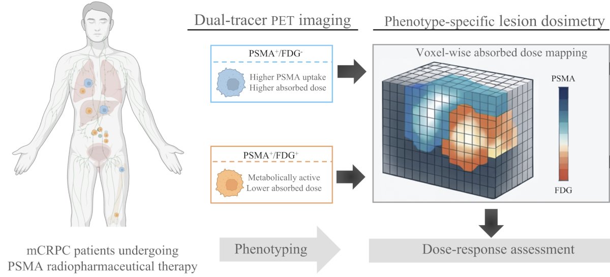 Lesions were segmented on both PET tracers and classified as PSMA-positive/FDG-negative (PSMA+/FDG−) or PSMA-positive/FDG-positive (PSMA+/FDG+). Within PSMA+/FDG+ disease, lesions were further categorized as PSMA-dominant or FDG-dominant. Voxel-wise absorbed dose maps were derived from SPECT: