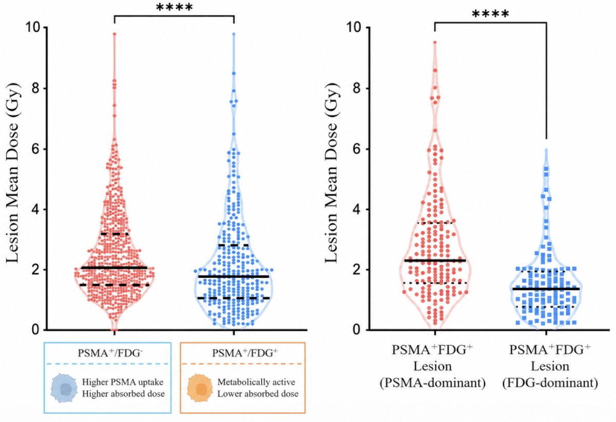 Lesion radiation delivery differed by metabolic phenotype. PSMA+/FDG− lesions received higher absorbed doses than PSMA+/FDG+ (concordant) lesions (median 2.10 versus 1.78 Gy; p < 0.0001). Within PSMA+/FDG+ disease, PSMA-dominant lesions received higher doses than FDG-dominant lesions (median 2.2 versus 1.3 Gy; p<0.0001):