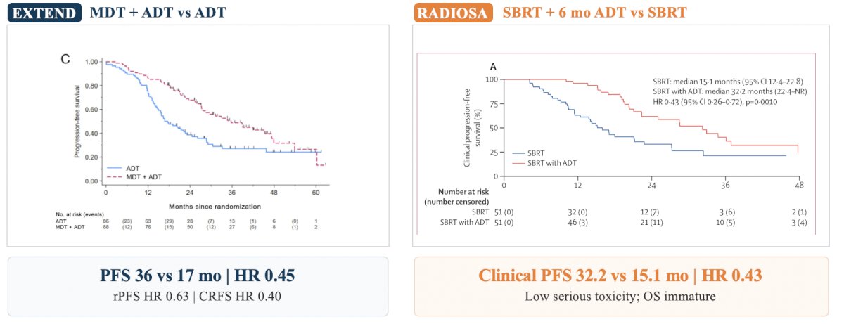 EXTEND6 and RADIOSA7 are complementary randomized trials evaluating integration of metastasis-directed therapy with systemic therapy. EXTEND addressed whether metastasis-directed therapy adds benefit to ADT, whereas RADIOSA assessed whether six months of ADT enhances outcomes following stereotactic body radiotherapy. In the combined intermittent and continuous ADT analysis of EXTEND, the median progression-free survival improved from 17 to 36 months (HR 0.45), while radiographic progression-free survival (HR 0.63) and castration resistance-free survival (HR 0.40) also improved. RADIOSA demonstrated that adding six months of ADT to stereotactic body radiotherapy prolonged clinical progression-free survival from 15.1 to 32.2 months (HR 0.43), with low rates of serious toxicity and immature overall survival data: