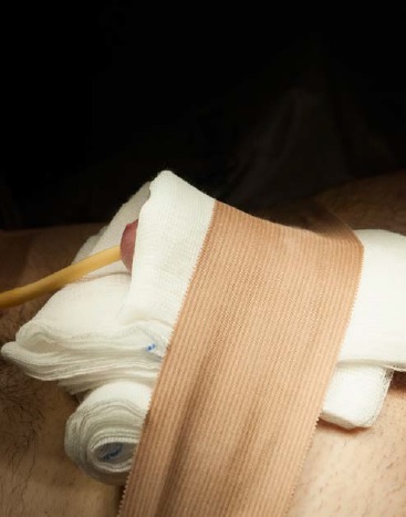 compressive bandage