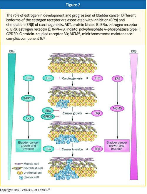 figure-2-epidemiology-bladder-cancer@2x.jpg