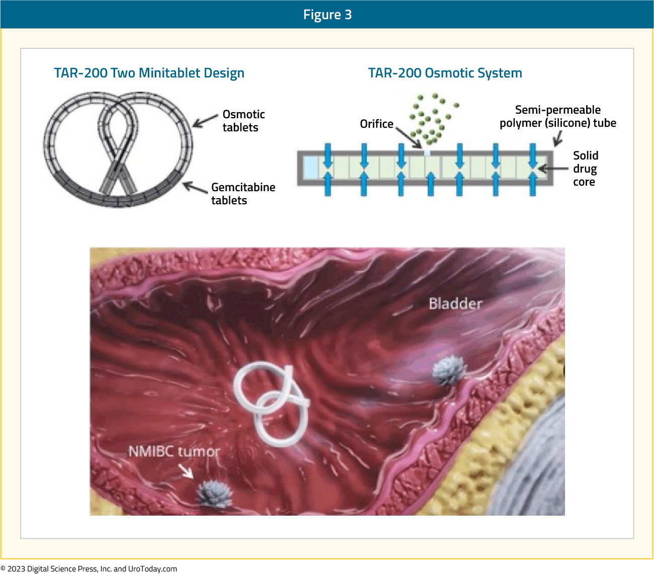 figure-3-intravesical-chemo.jpg