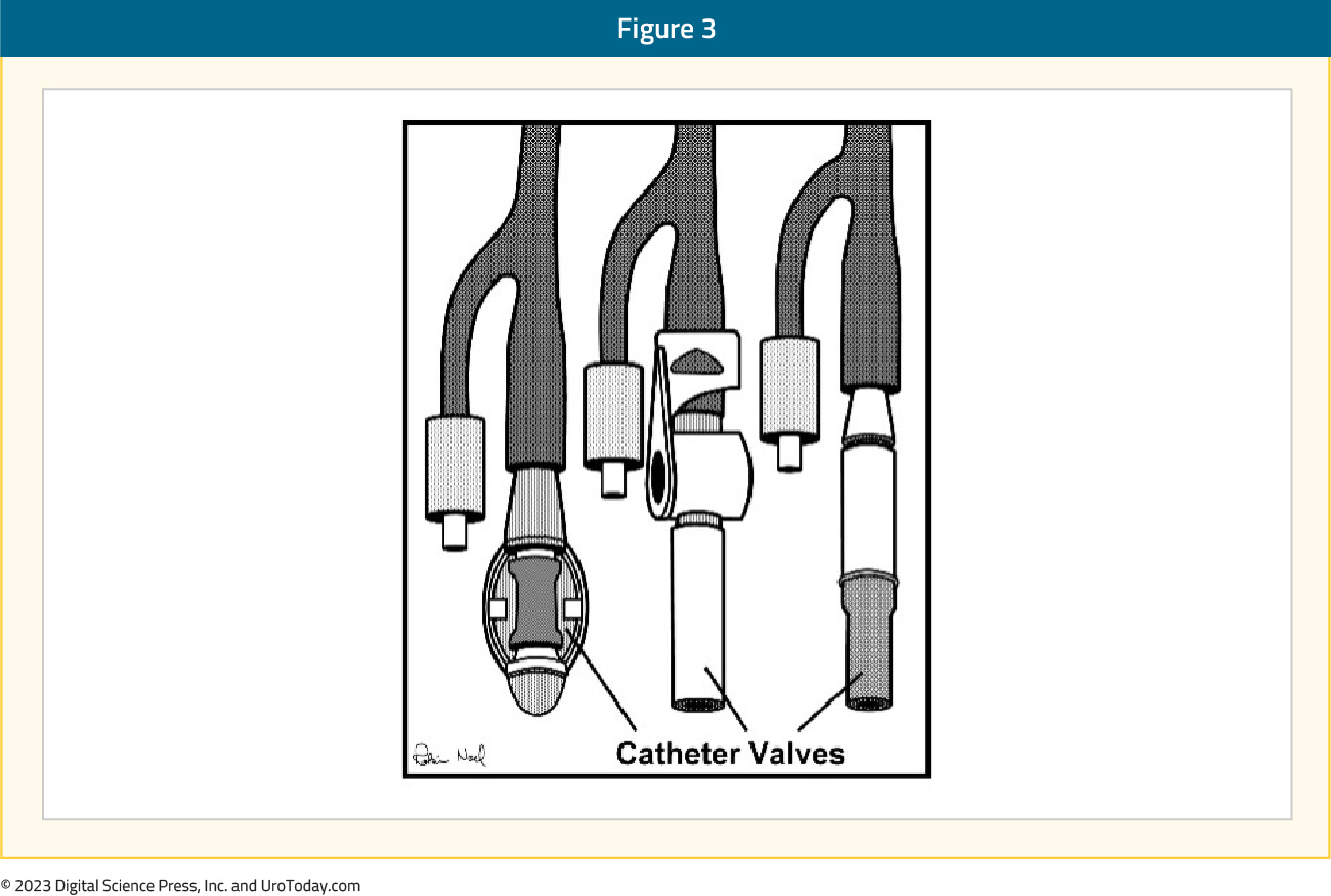 figure-3-urinary-catheter-valves2x.jpg