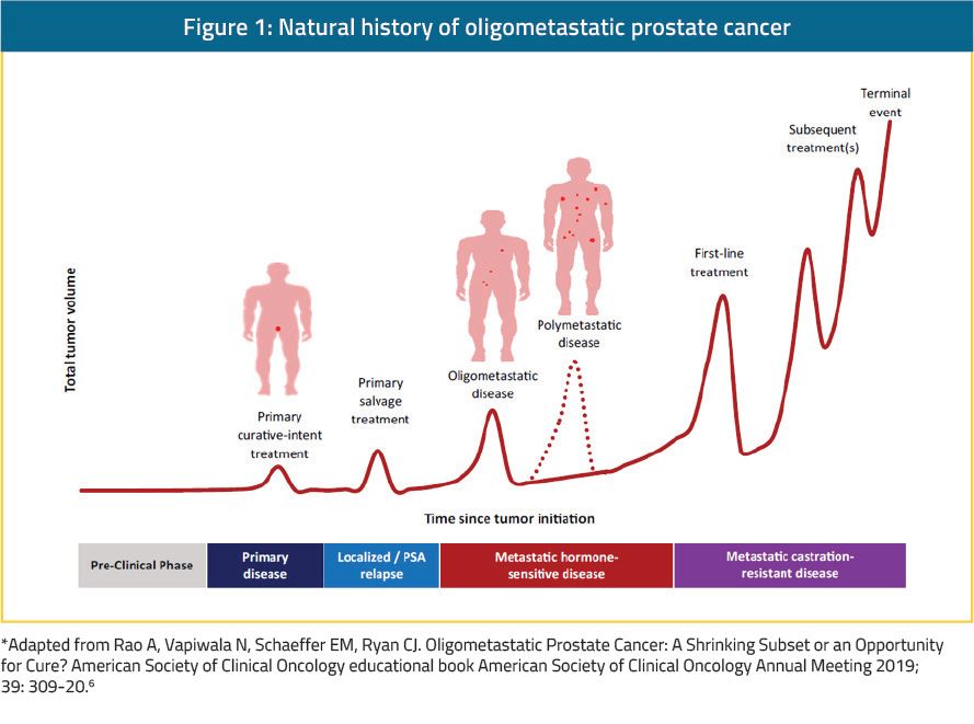 figure 1 natural history of oligometastatic prostate cancer