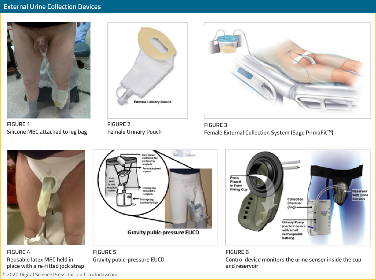 Women Guide For Urine Collection - Ovus Medical