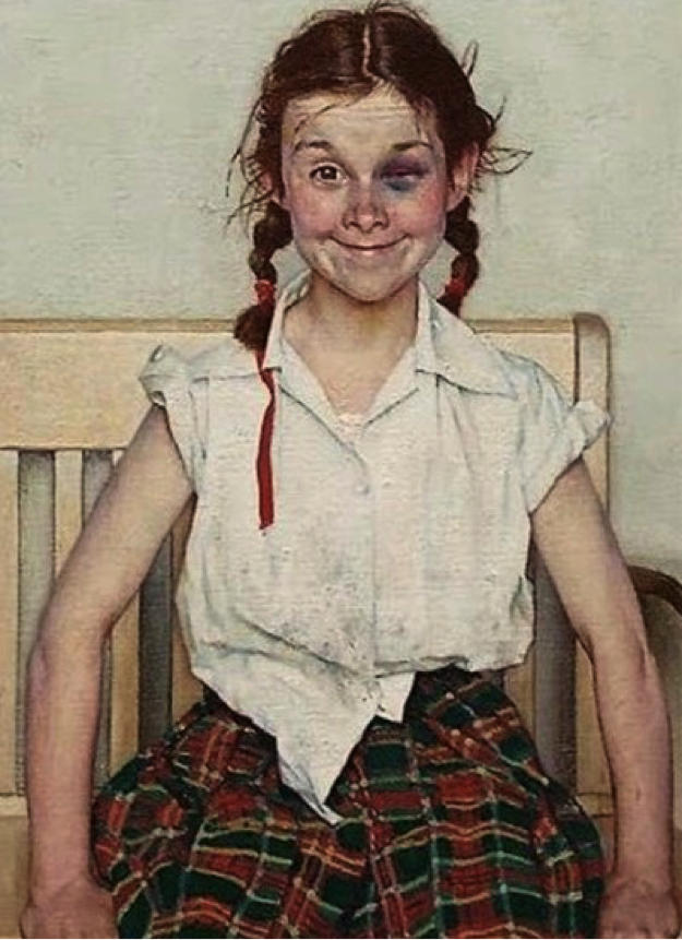 girlwblackeye