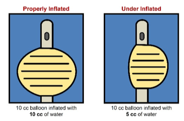 proper_inflated_balloon.png