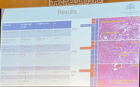 results of using turbt technology