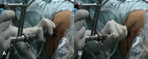 bta lezrek-fig-3 thumb