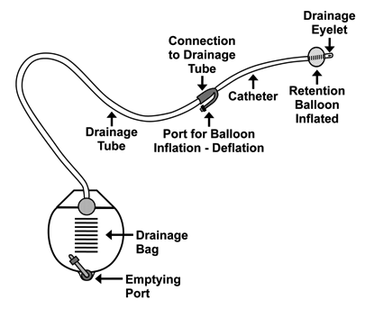 iuc system