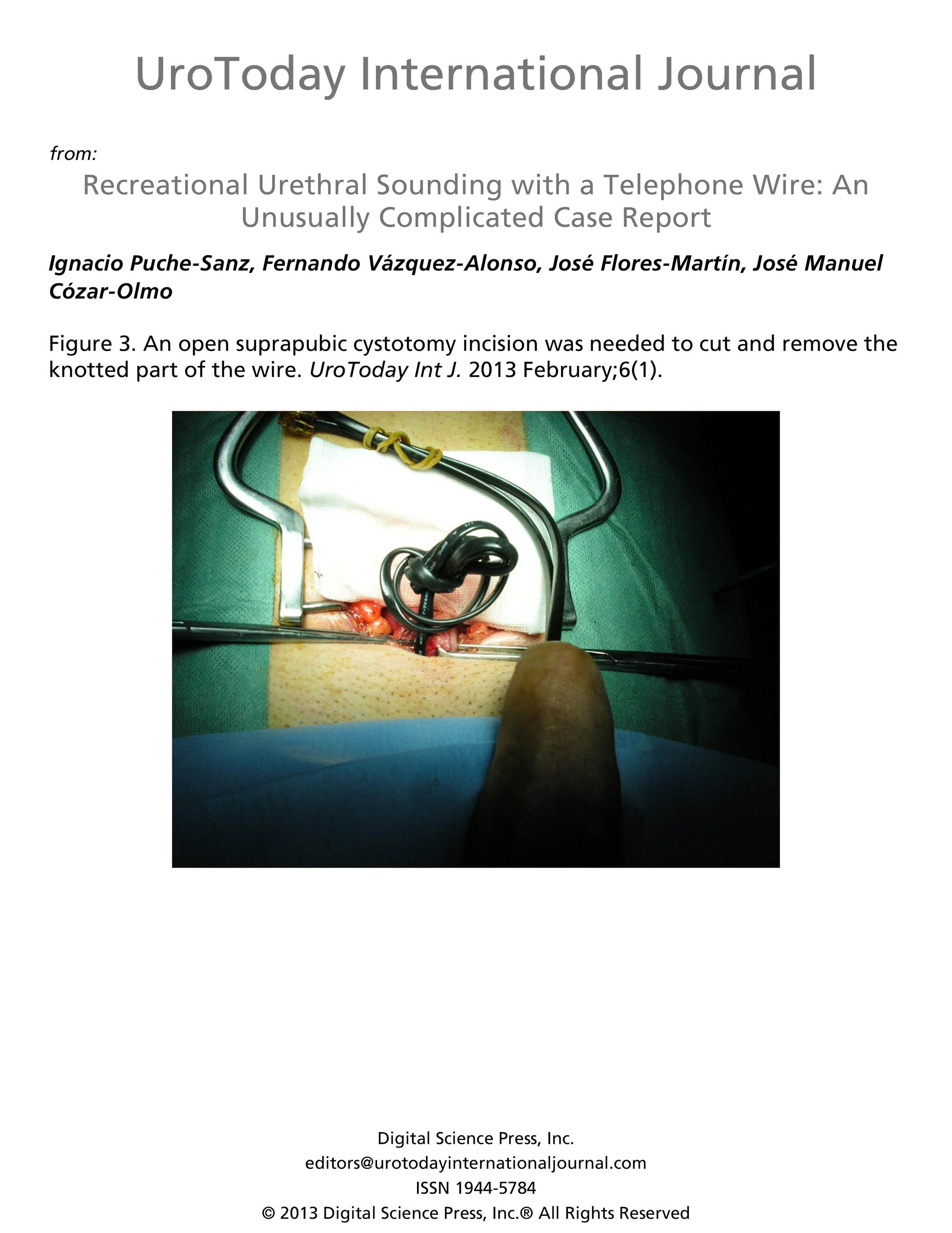 Recreational Urethral Sounding with a Telephone Wire An Unusually Complicated Case Report