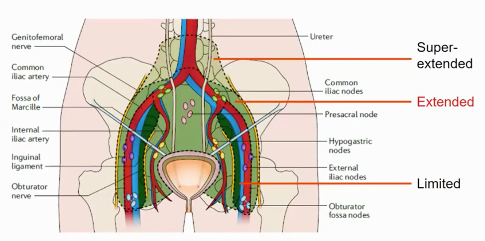 template extended lymph node dissection